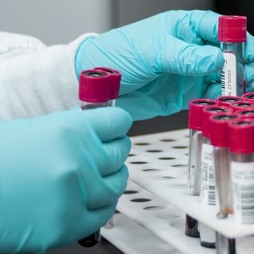 כפפות ניטריל לחדרים נקיים